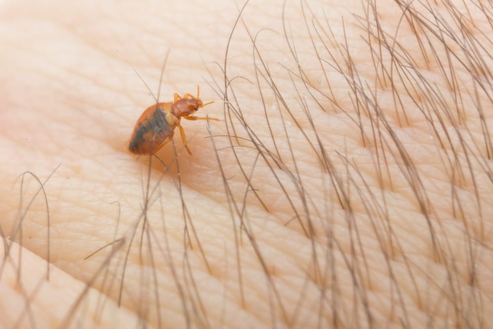 A bed bug crawling across skin