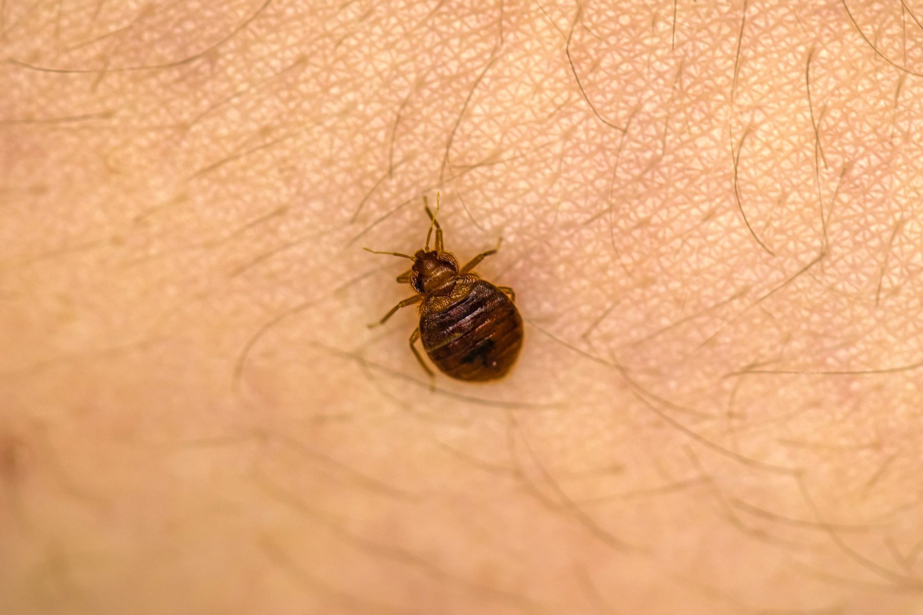 Bed bug up close on skin.