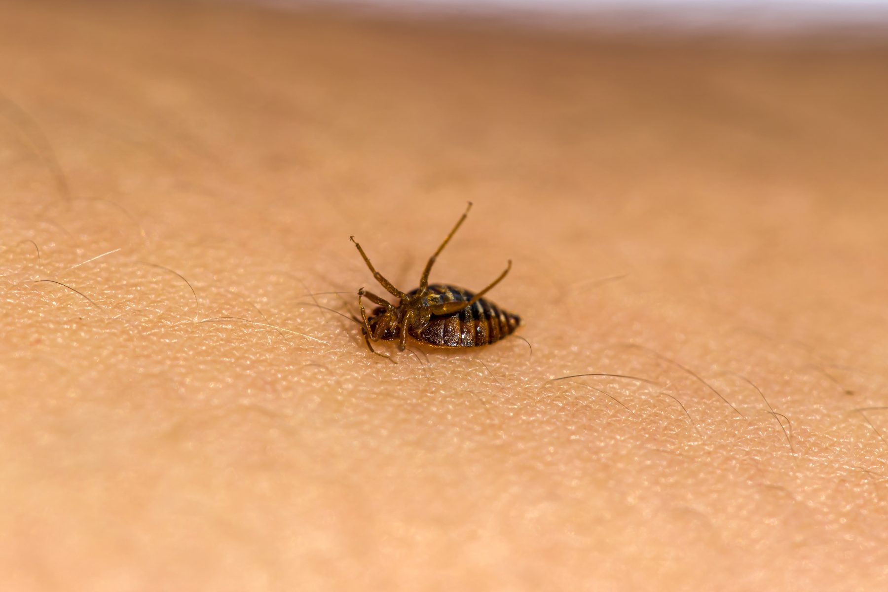 Dead bed bug on person's skin. 