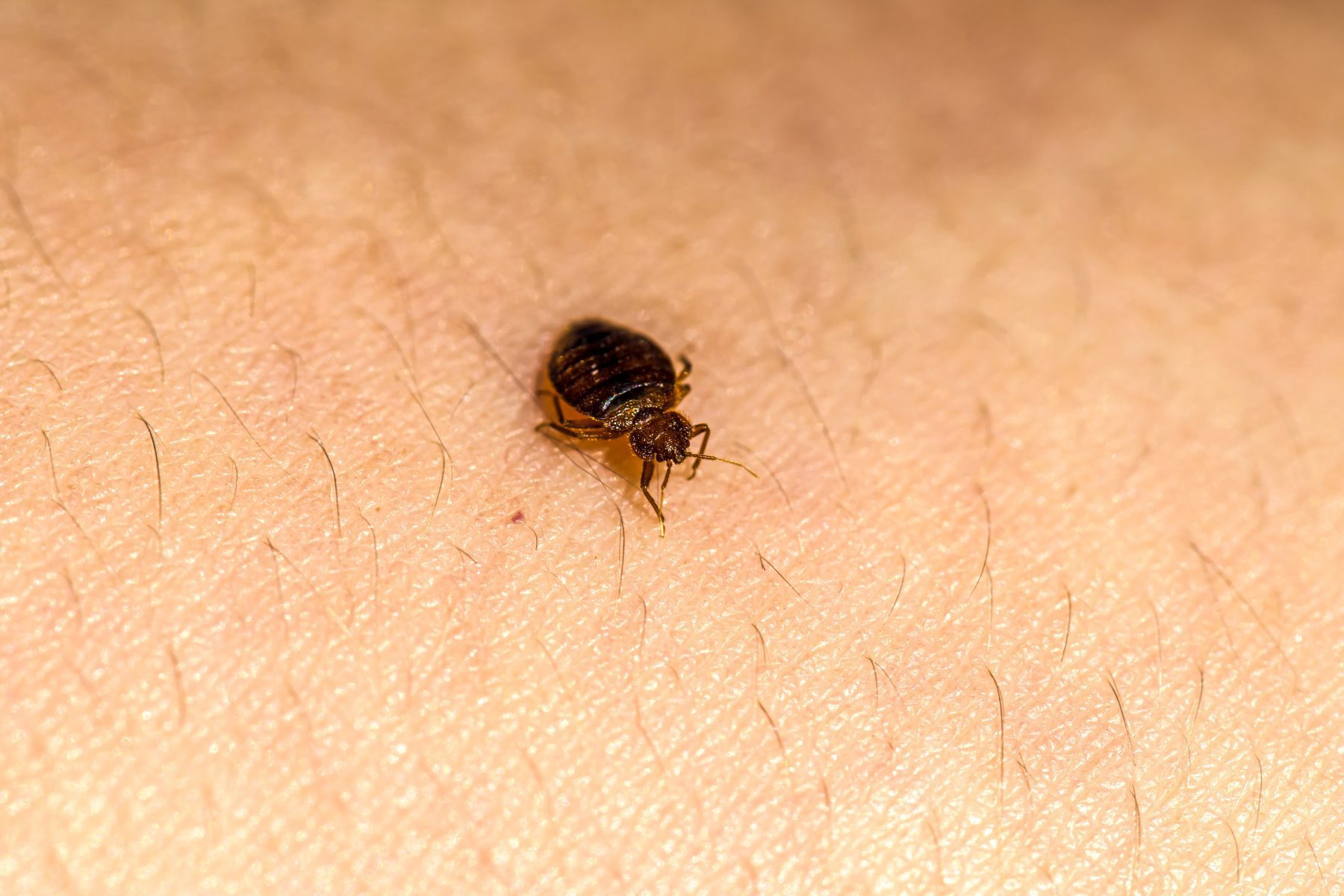 Closeup of bed bug on skin.