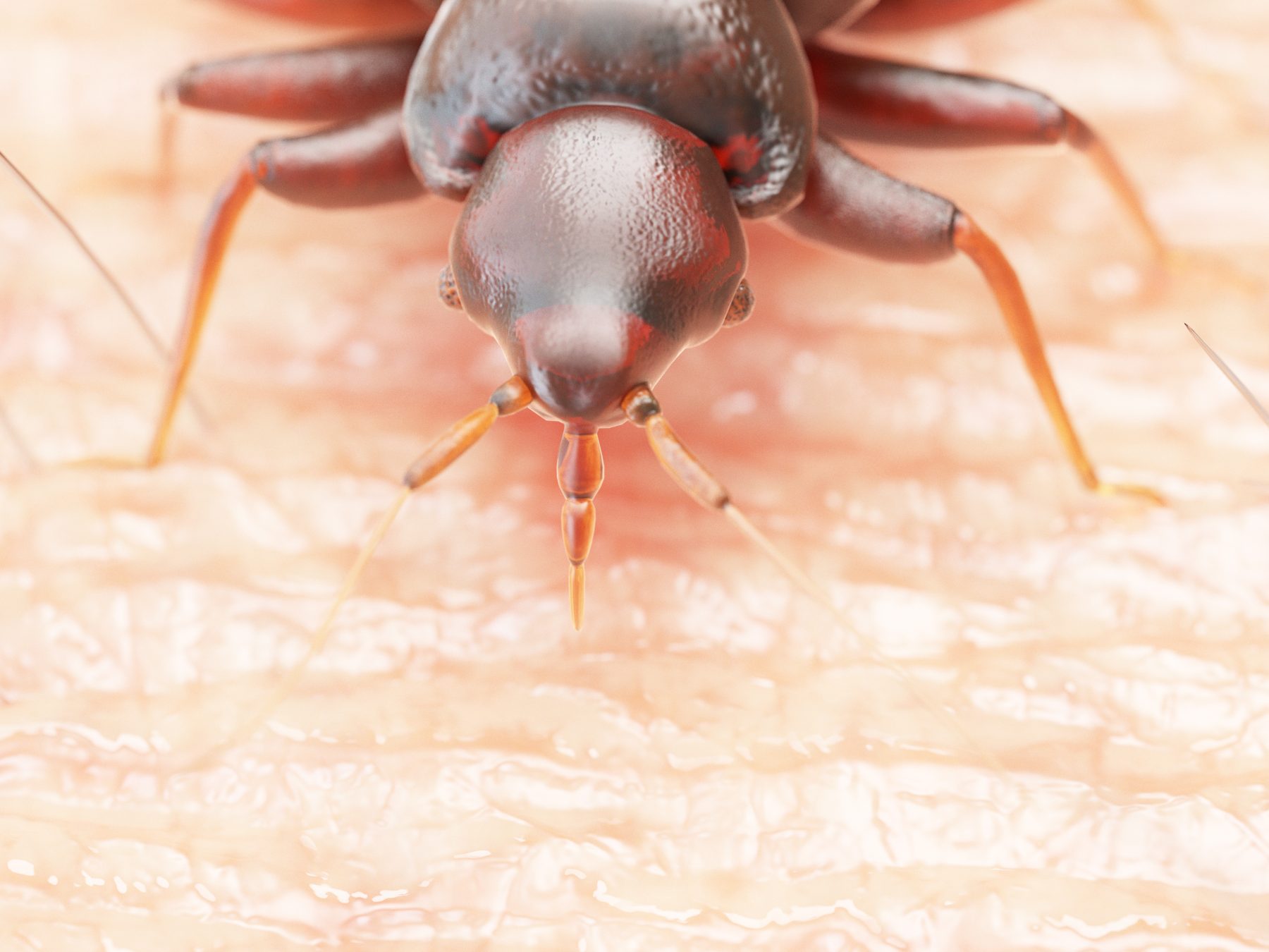 Very close up shot of bed bug on someone's skin