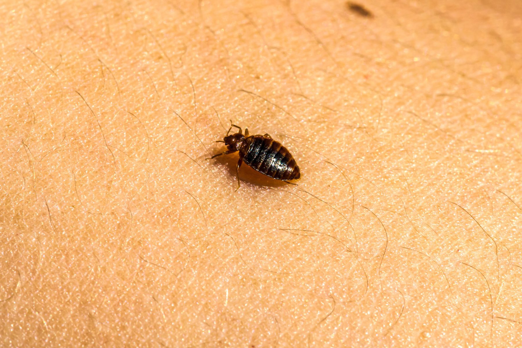 Bed bug on someone's skin