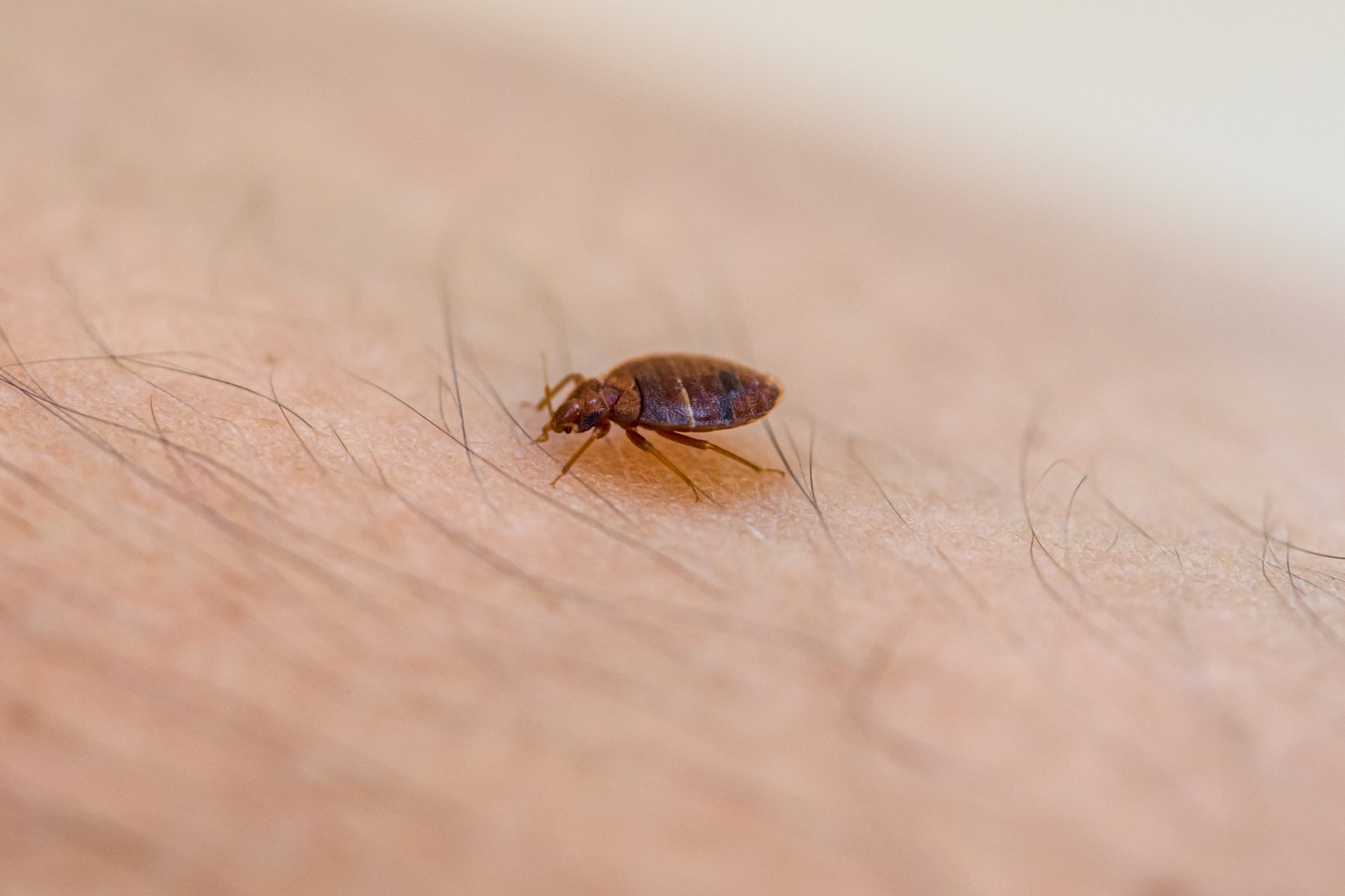 Close up of bed bug on someone's skin