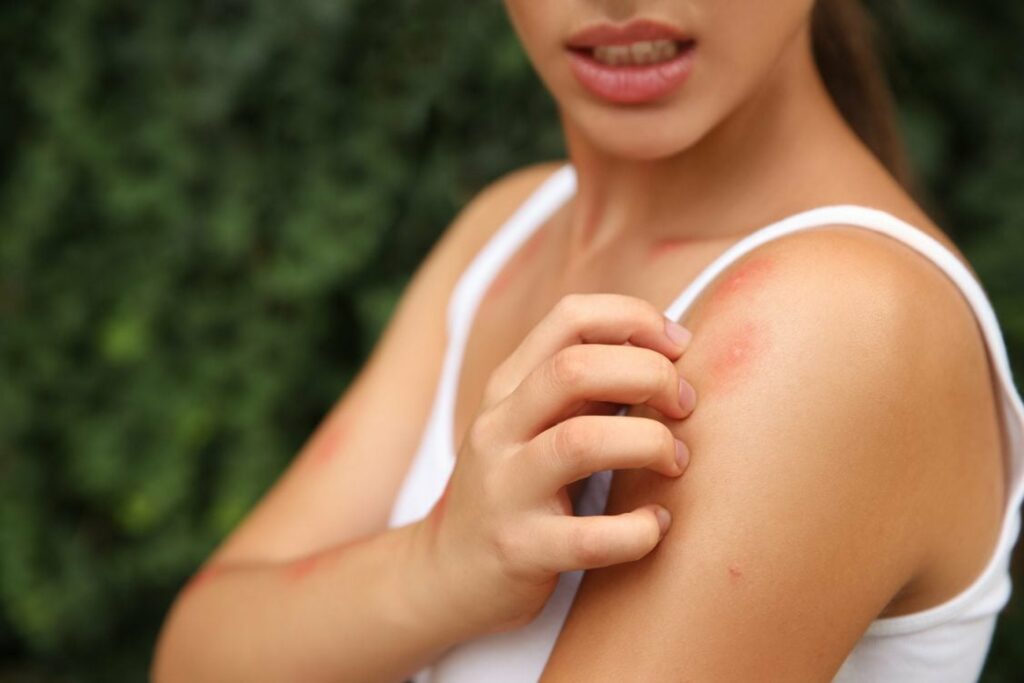 Girl scratching her arm from a bug bite